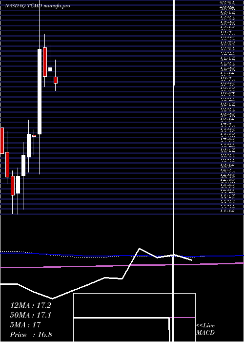  monthly chart TactileSystems